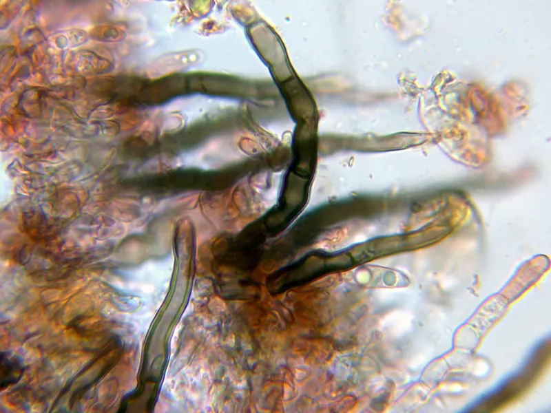 Colletotrichum trichellum 10 - Hifas conidiógenas-001